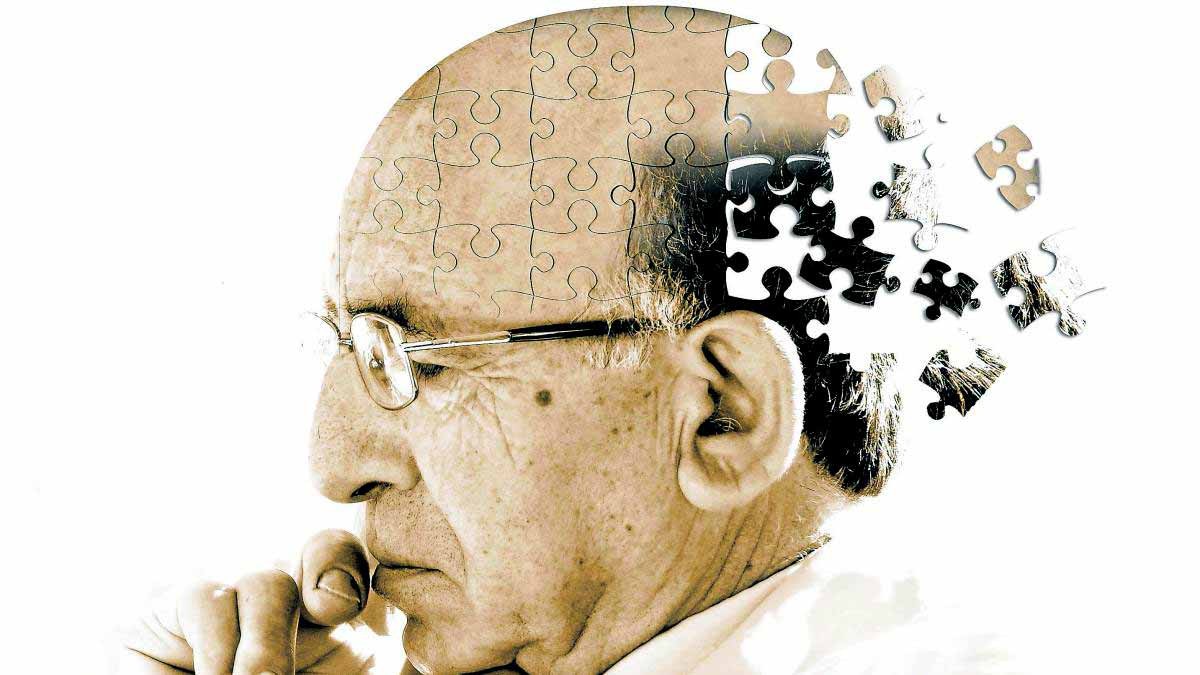 Enfermedad del Alzheimer o demencia senil
