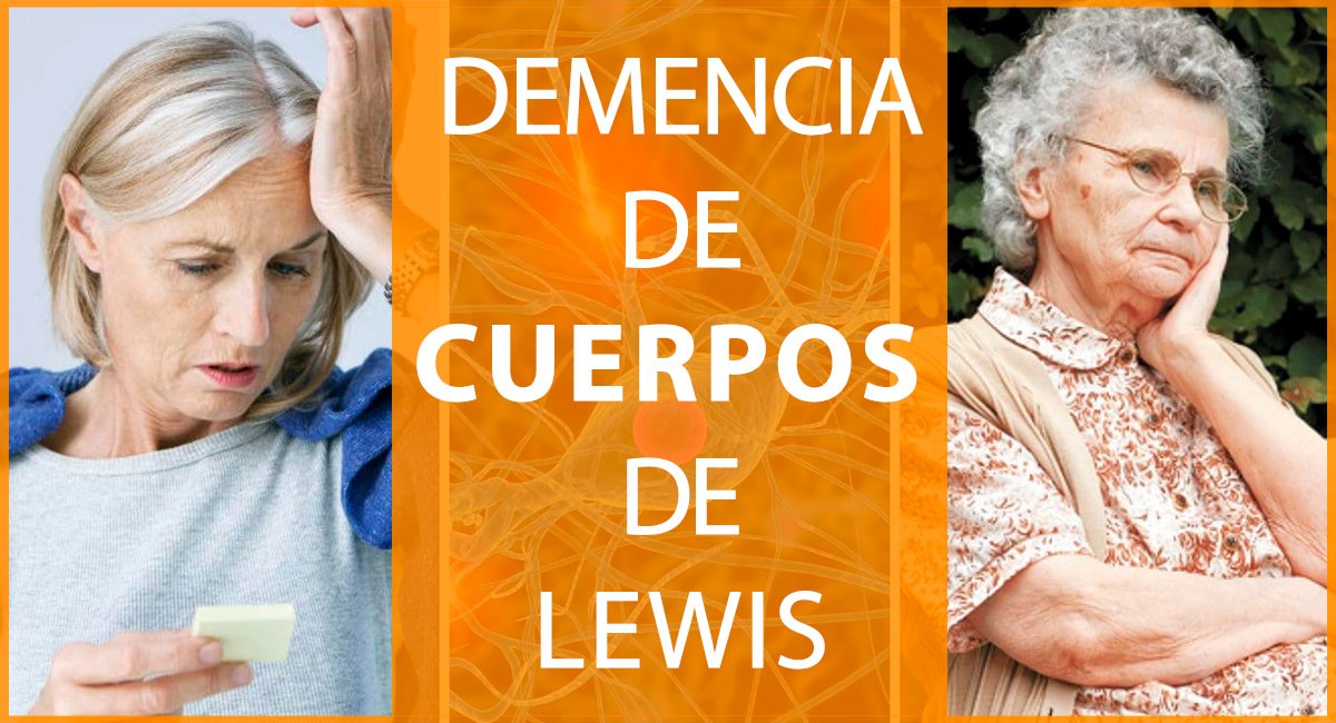 Cuerpos-de-Lewis-portada